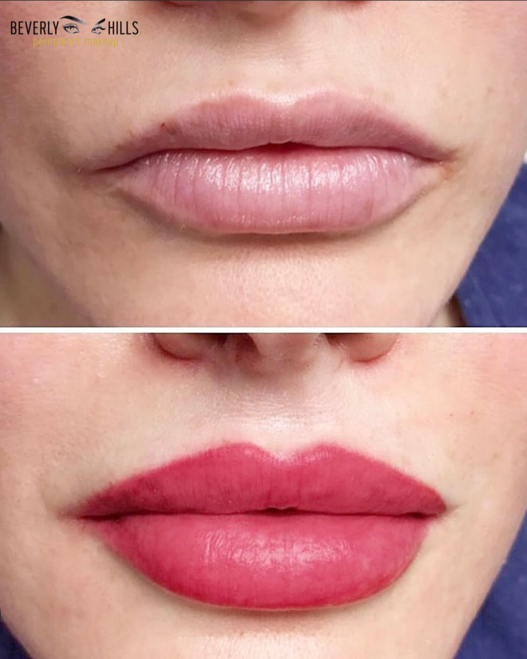 Lip blush permanent makeup result — full natural color and definition by Beverly Hills PMU Sarasota FL